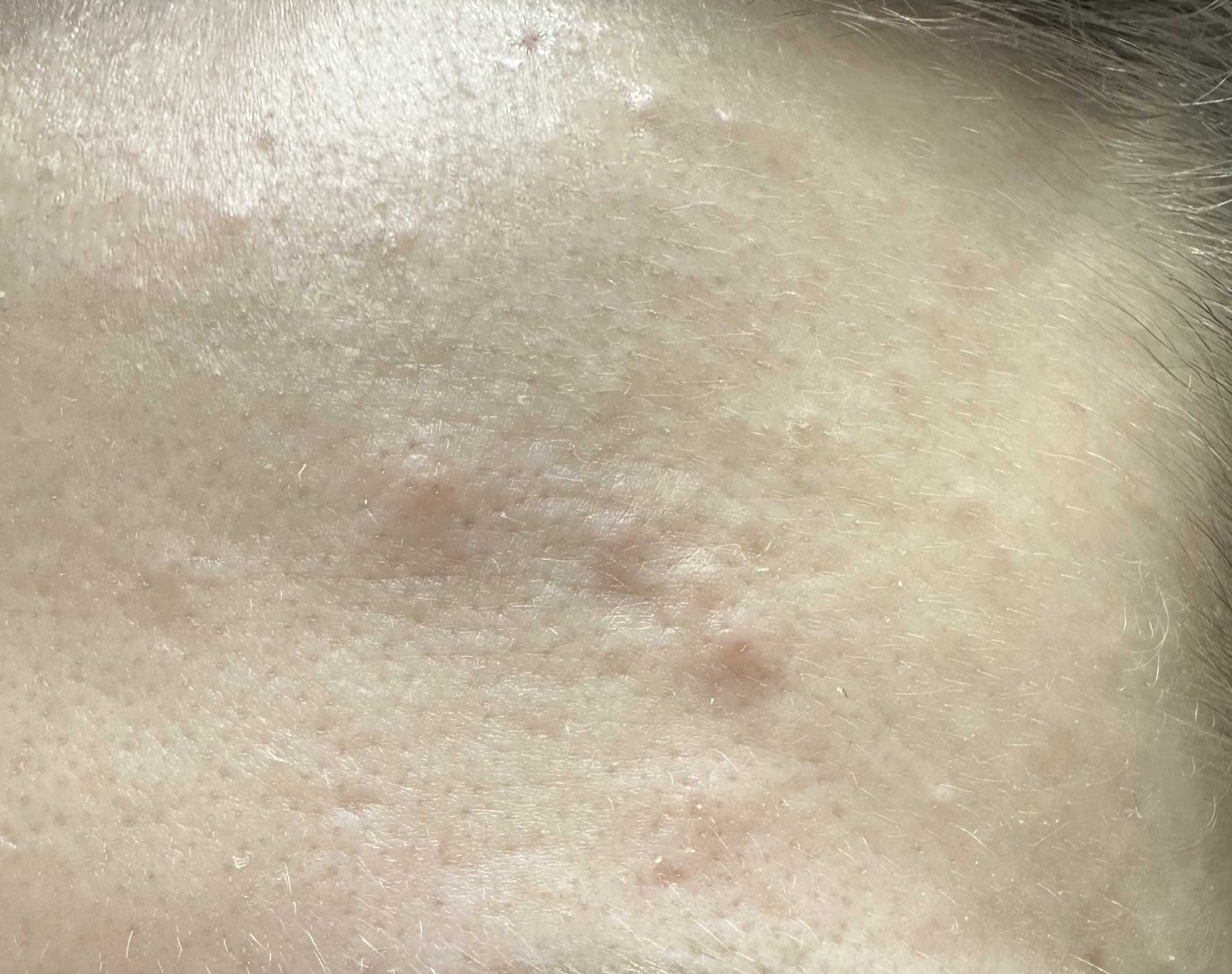 Regeneracja skóry · 72 h — przed kuracją