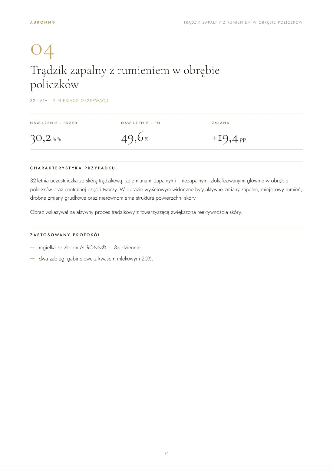 Skóra trądzikowa — pielęgnacja domowa AURONN® + dwa zabiegi z kwasami — strona 14