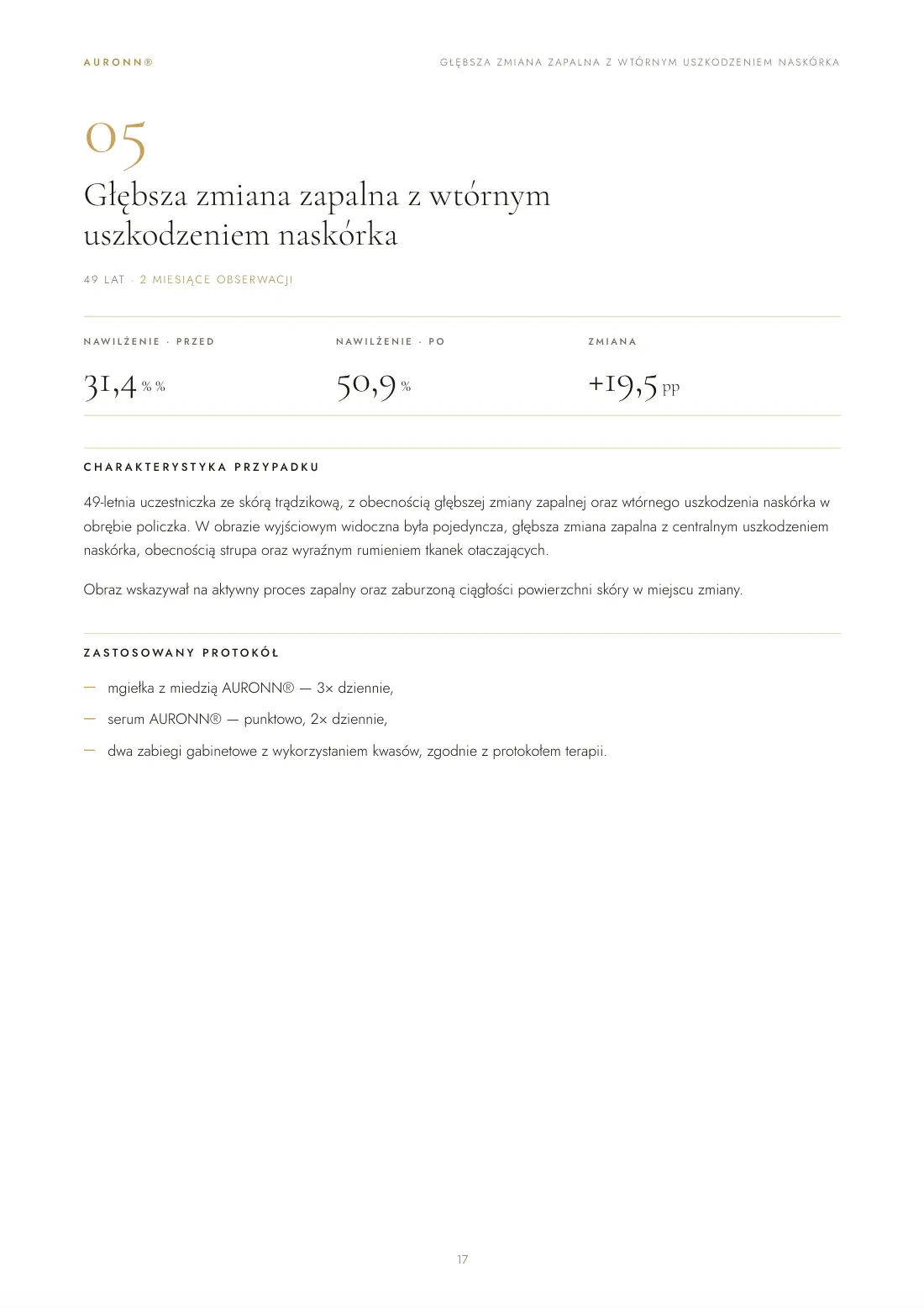 Skóra trądzikowa — pielęgnacja domowa AURONN® + dwa zabiegi z kwasami — strona 17