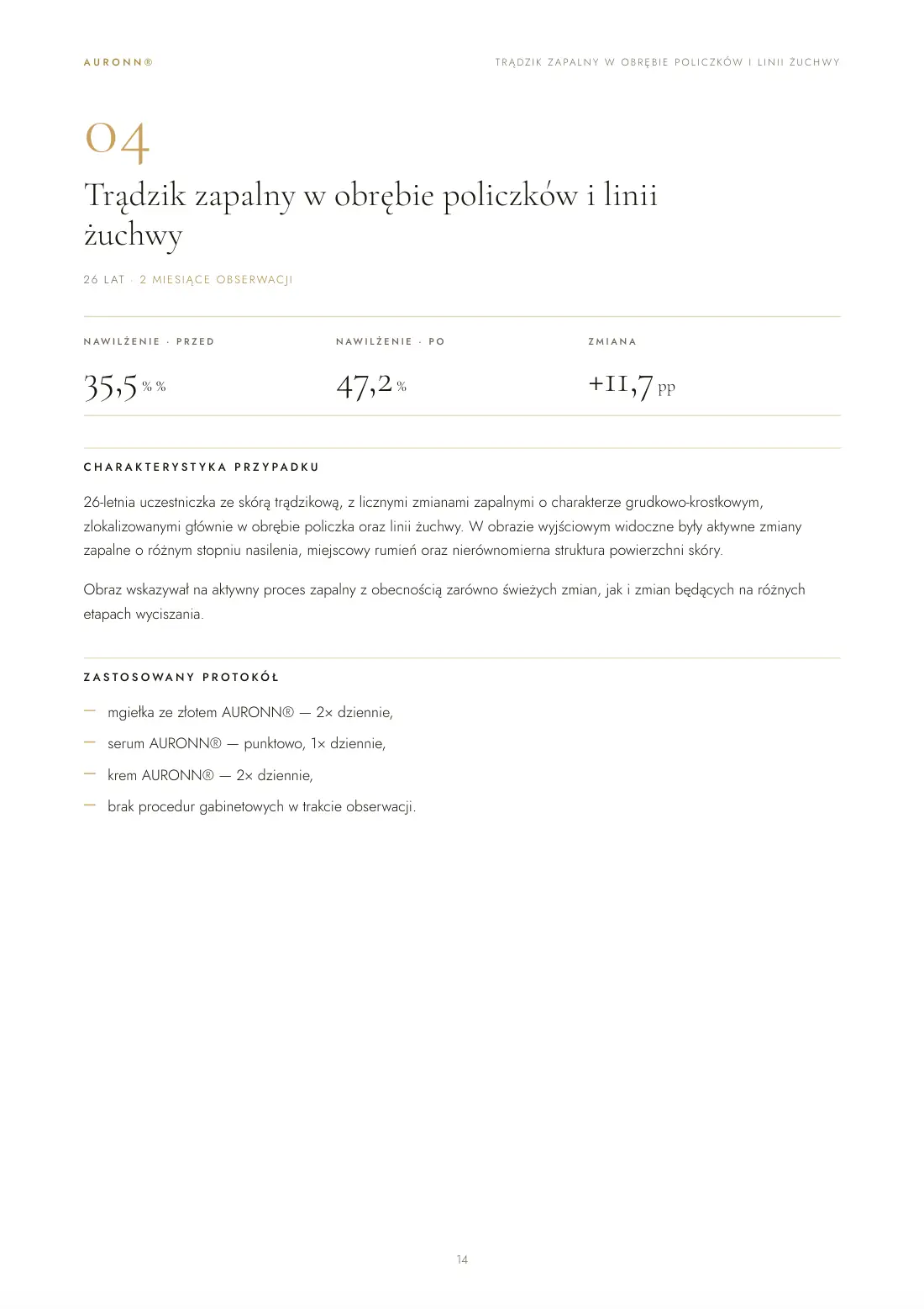 Skóra trądzikowa — wyłącznie pielęgnacja domowa AURONN® — strona 14
