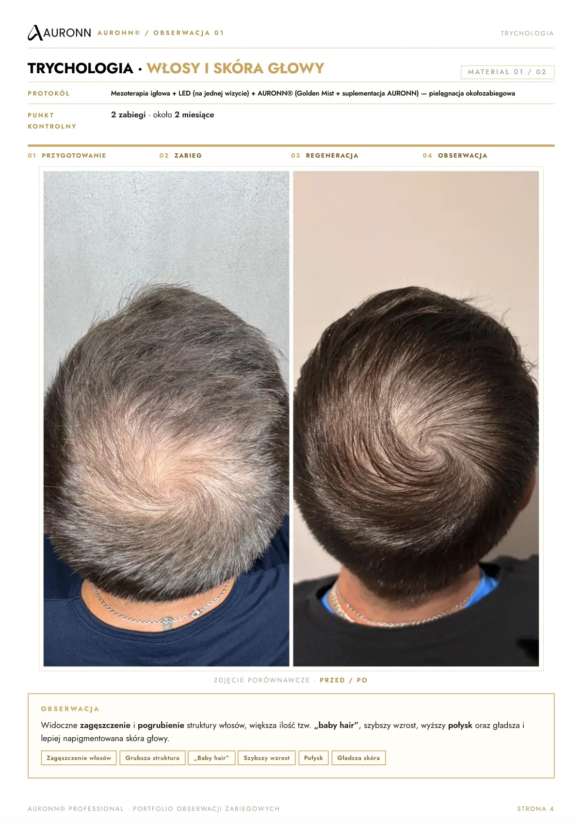 AURONN® Portfolio obserwacji zabiegowych — strona 4
