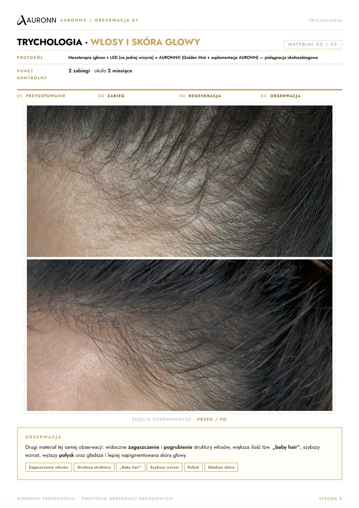 AURONN® Portfolio obserwacji zabiegowych — strona 5