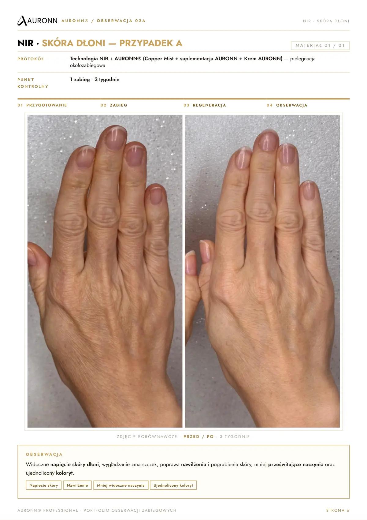 AURONN® Portfolio obserwacji zabiegowych — strona 6