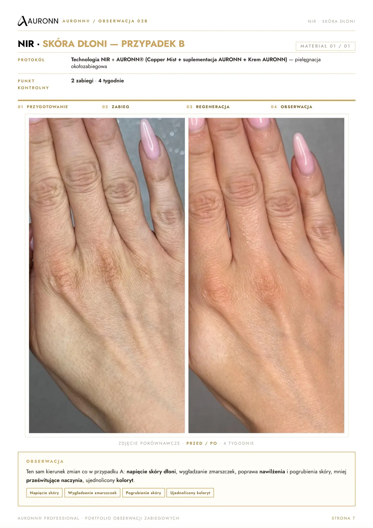 AURONN® Portfolio obserwacji zabiegowych — strona 7
