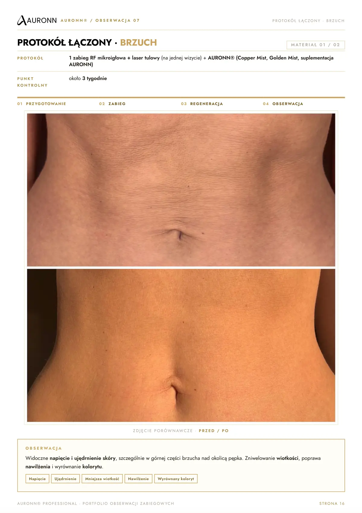 AURONN® Portfolio obserwacji zabiegowych — strona 16