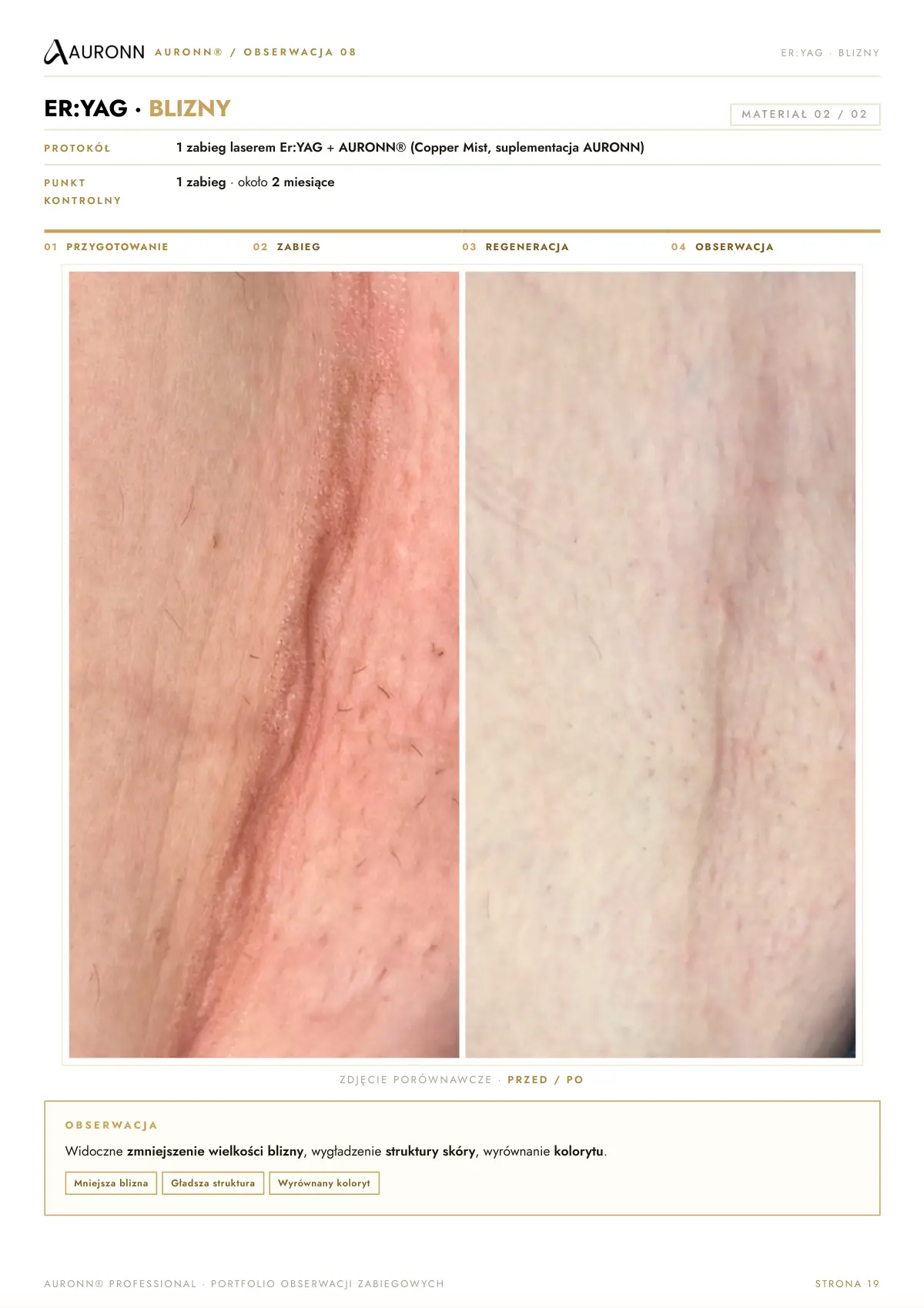 AURONN® Portfolio obserwacji zabiegowych — strona 19
